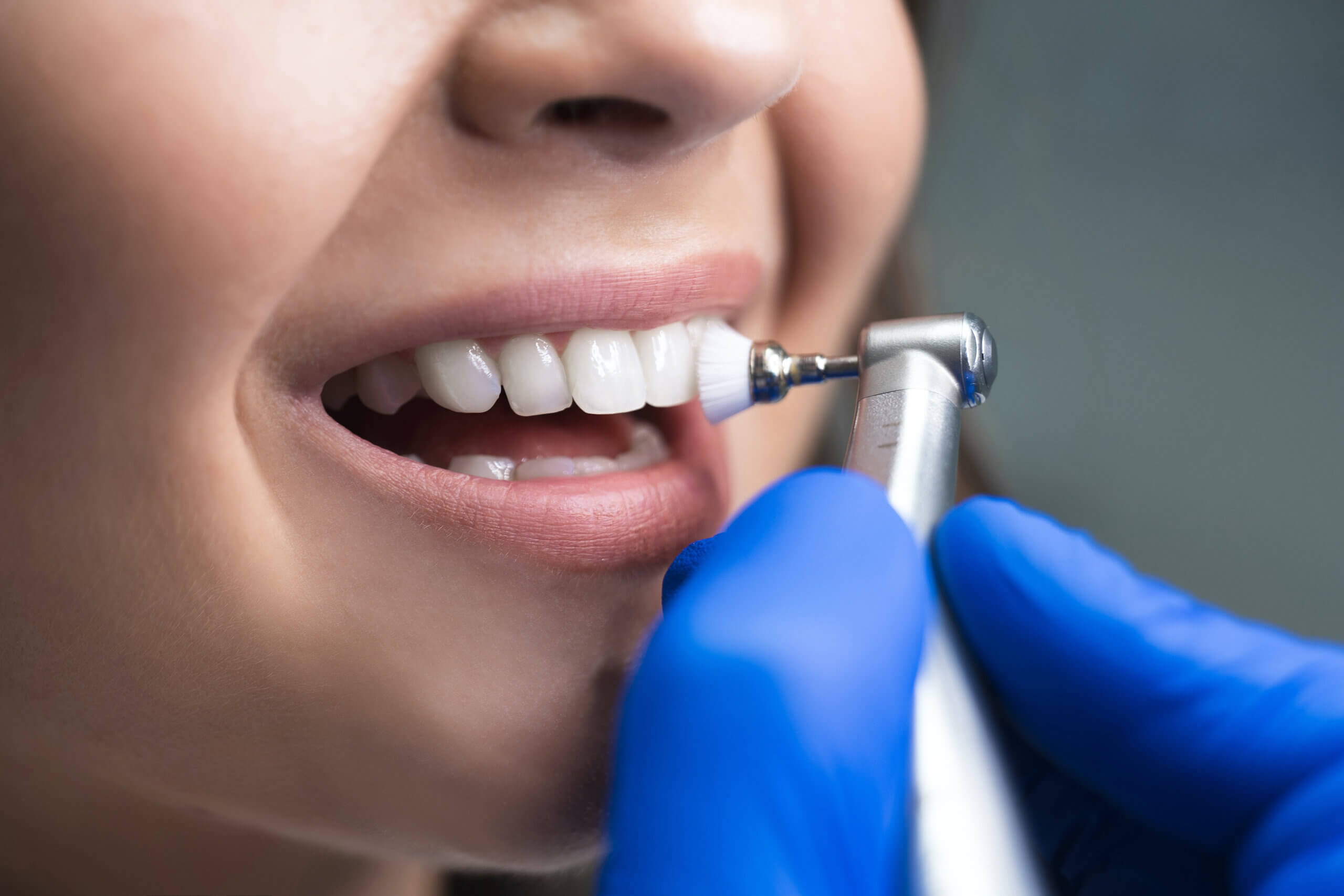 Proper Dental Care Tips and Why it's so Important Vero Elite Dentistry